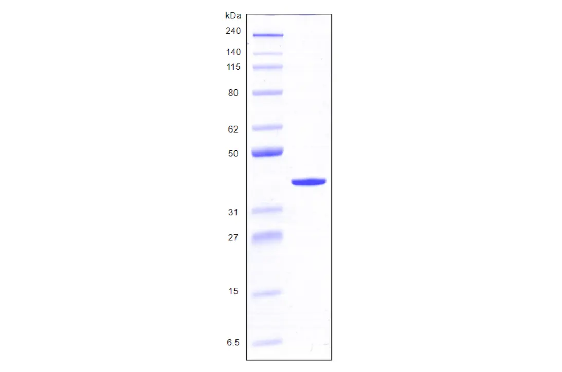 Recombinant Human Galectin 8, variant 1, His Tag (317 a.a.) -50 ug